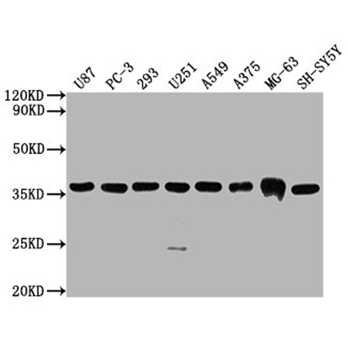 GST Monoclonal Antibody