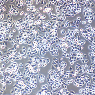 HCC-78 人肺腺癌細胞