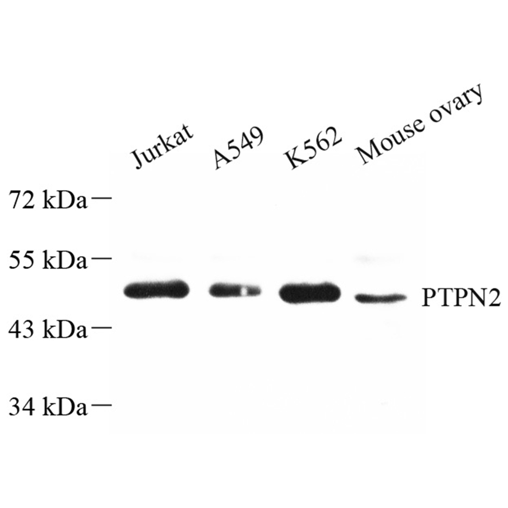 Anti -TCPTP Rabbit pAb