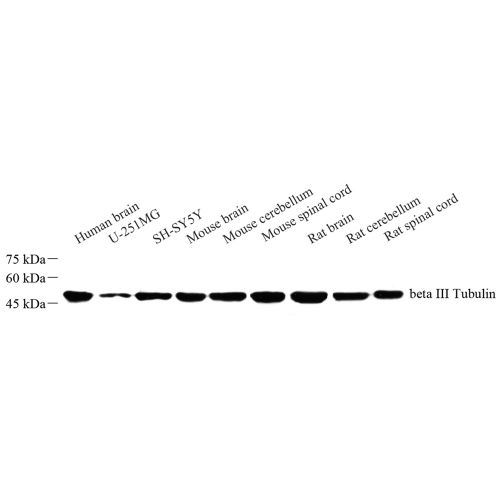 Anti -beta III Tubulin Rabbit pAb