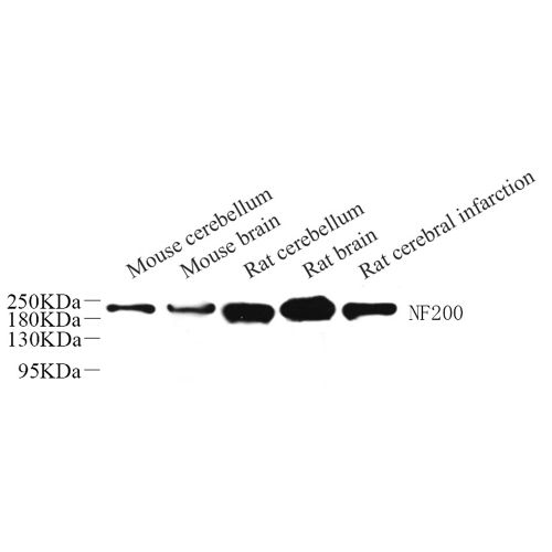 Anti -alpha Internexin Rabbit pAb