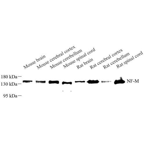 Anti -160 kDa Neurofilament Medium Rabbit pAb