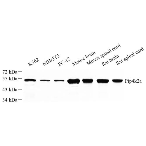 Anti -PIP4K2 Rabbit pAb