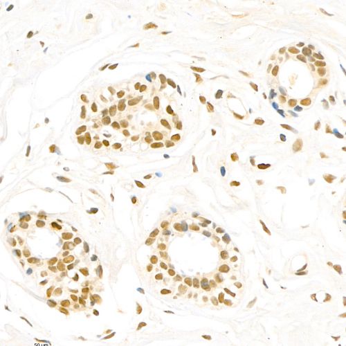 Anti -Topoisomerase II alpha Rabbit pAb