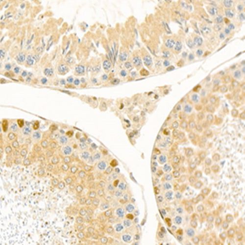 Anti -Exonuclease 1 Rabbit pAb