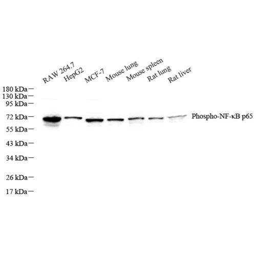 Anti -P-NFkBp65 Rabbit pAb